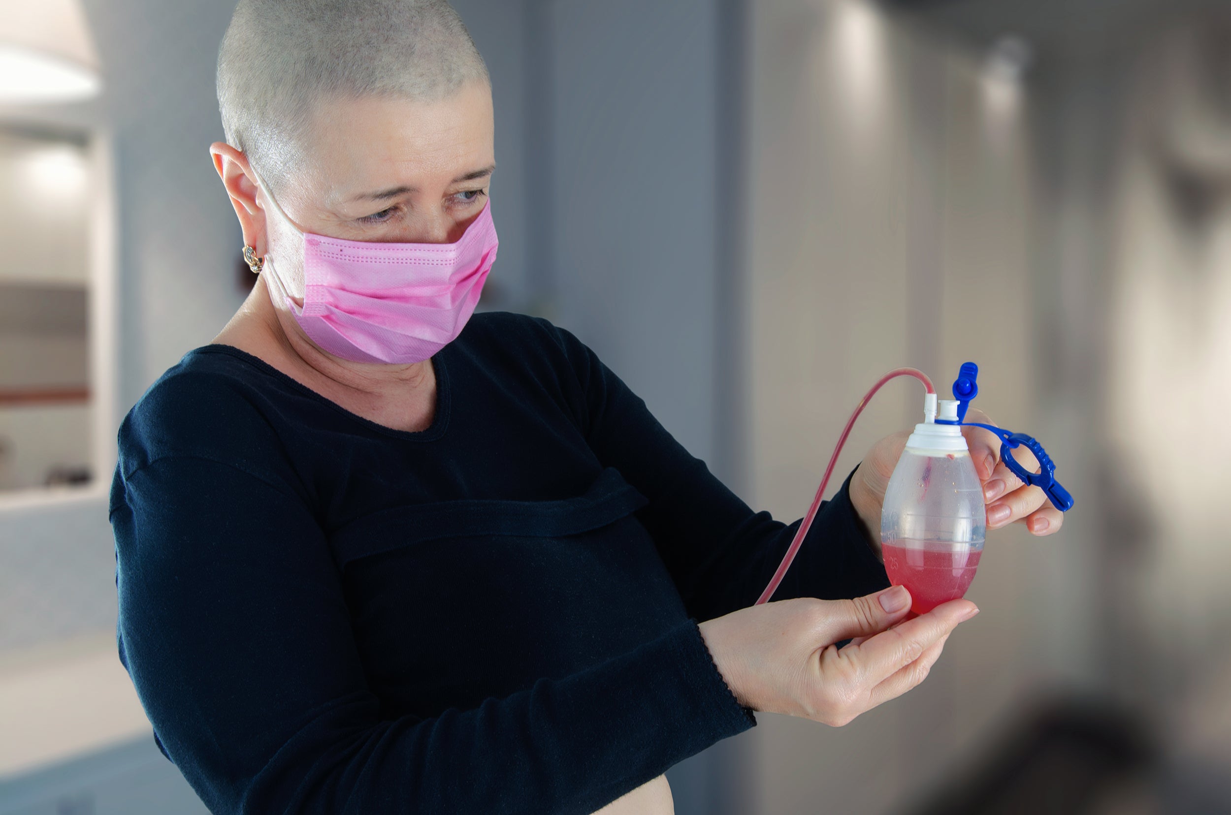 A woman holds a mastectomy drain. Everything you need to know about mastectomy drains before surgery — how they work, how long they stay in, and what to wear during recovery.